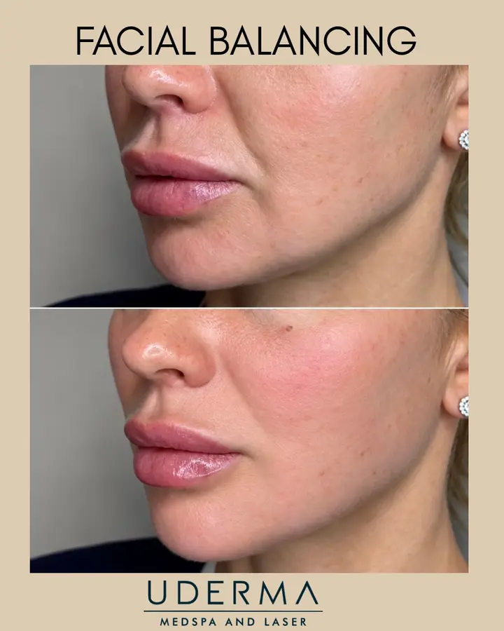 If you’re starting to notice that your face is losing its youthful contour…