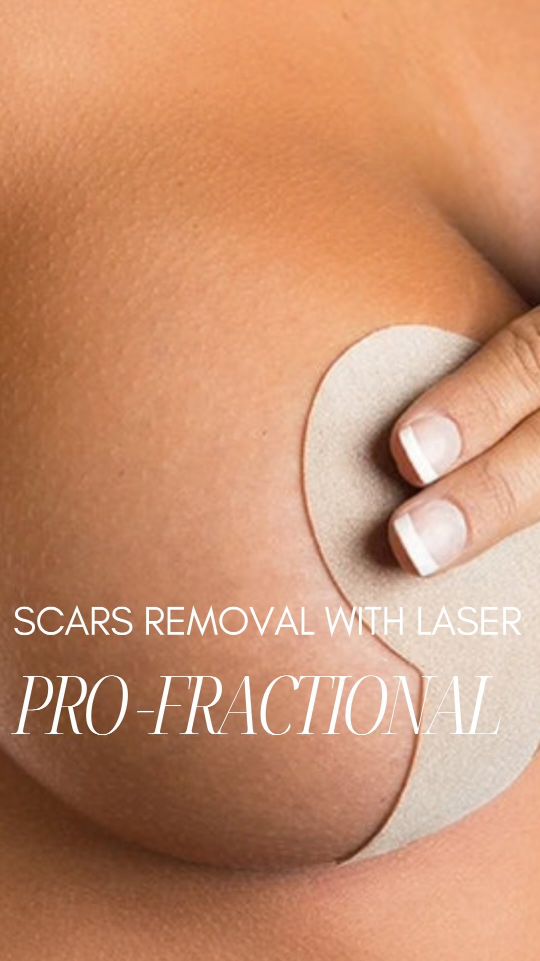 🌟 Say Goodbye to Scars! 🌟