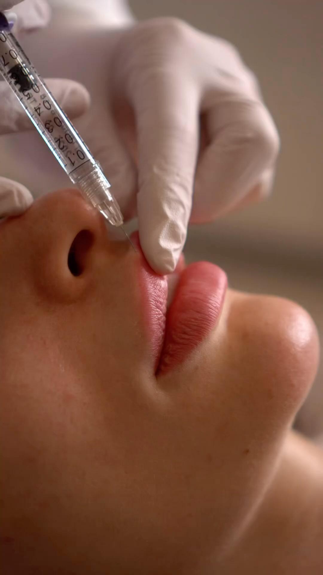 Just a friendly reminder that there is only one month until Valentines Day! Book your lip filler app