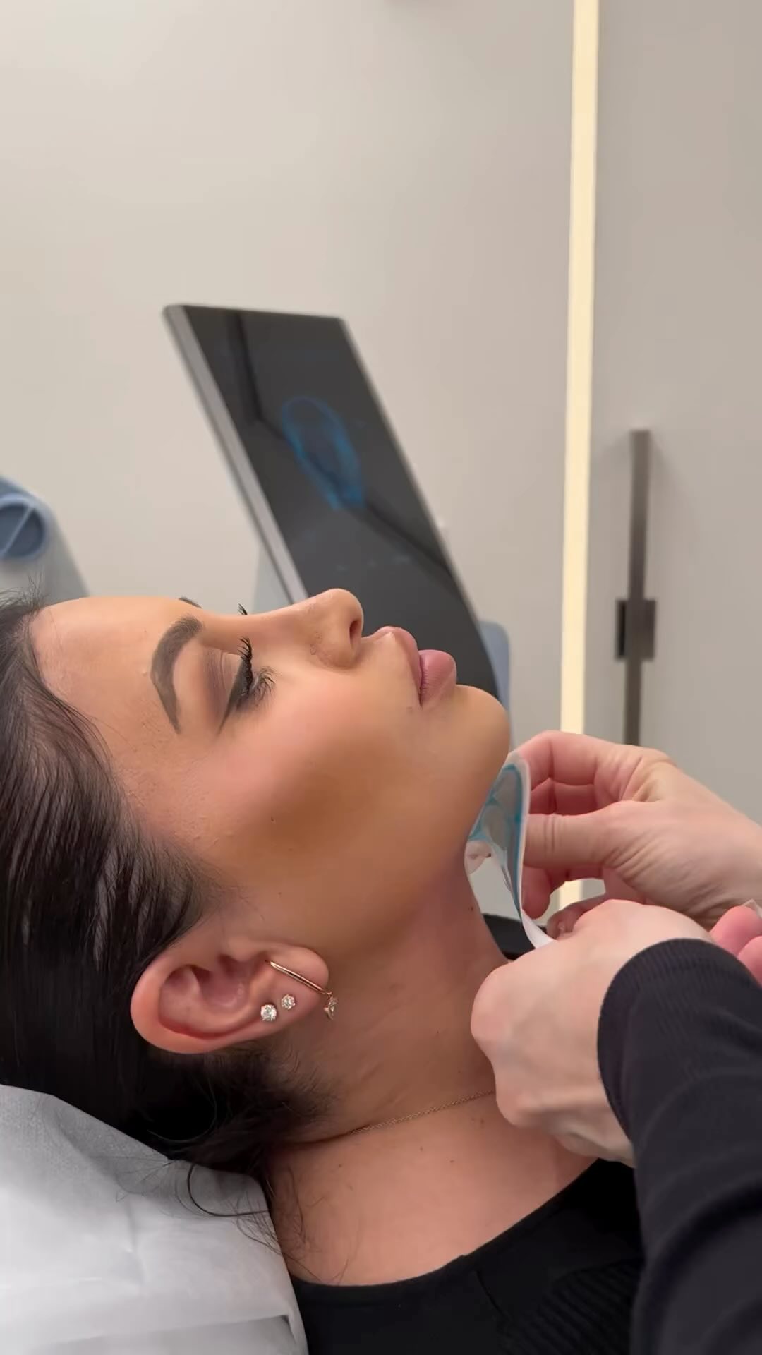EMFACE Submentum New Treatment Area!⭐️