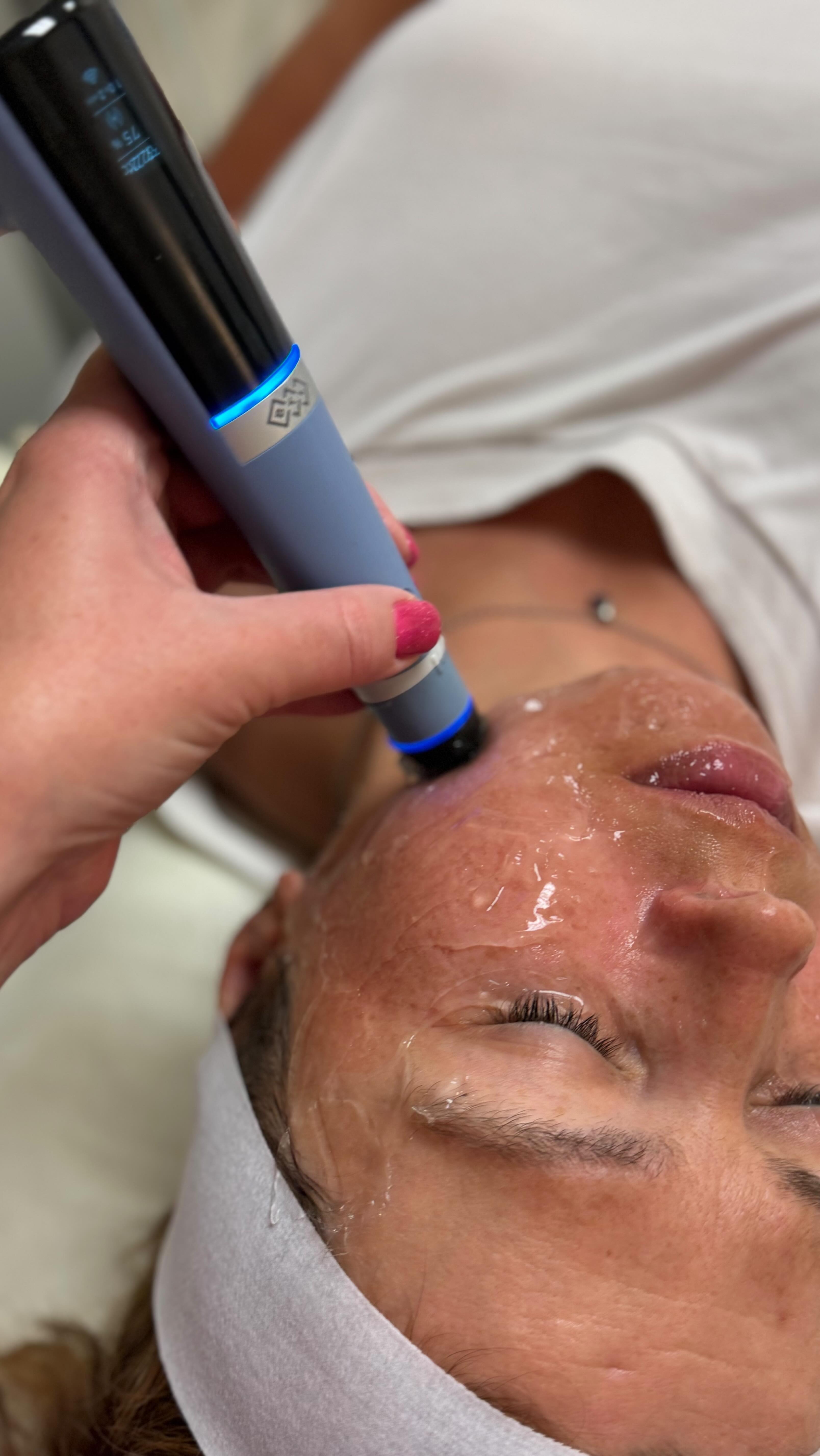 "Discovering the natural way to boost hyaluronic acid production with Exion ultrasound! Say hello to