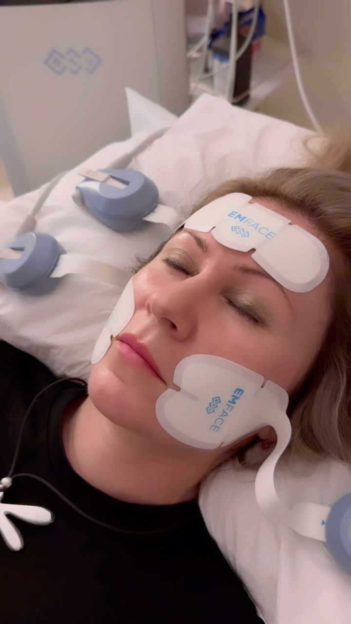EMFACE is the needle-free procedure that reduces wrinkles and provides more lift. EMFACE is the firs