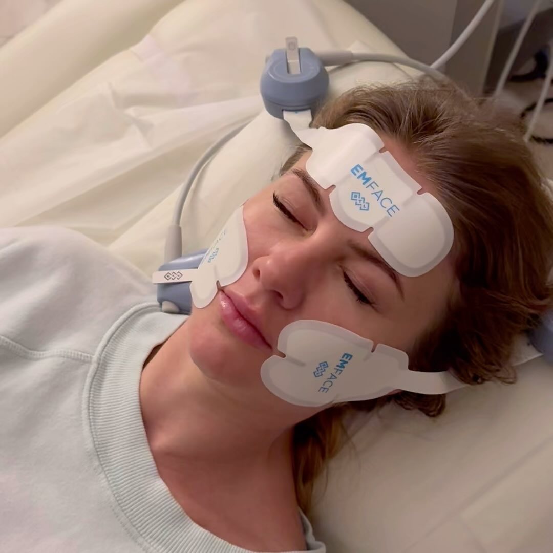 EMFACE uses cutting-edge technology to stimulate muscle contraction and rejuvenate skin tissue.