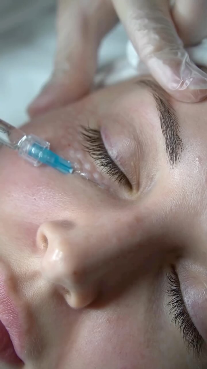 Skin boosters for the eye area aim to hydrate, rejuvenate, and improve the texture and elasticity of