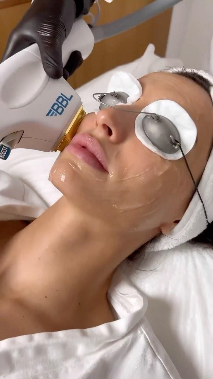 BBL HERO is clearly the treatment of choice by Hollywood’s biggest names!