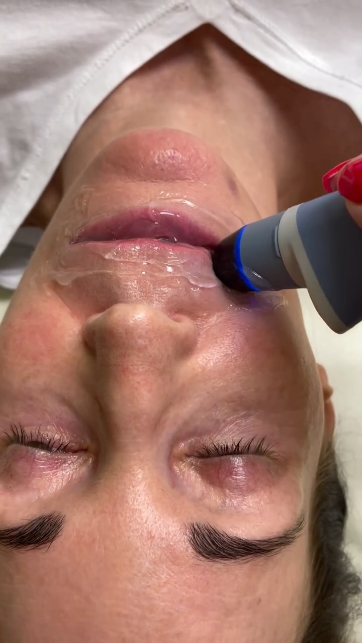 Fuller lips without needles & filler?! EXION LIP PLUMPER✨