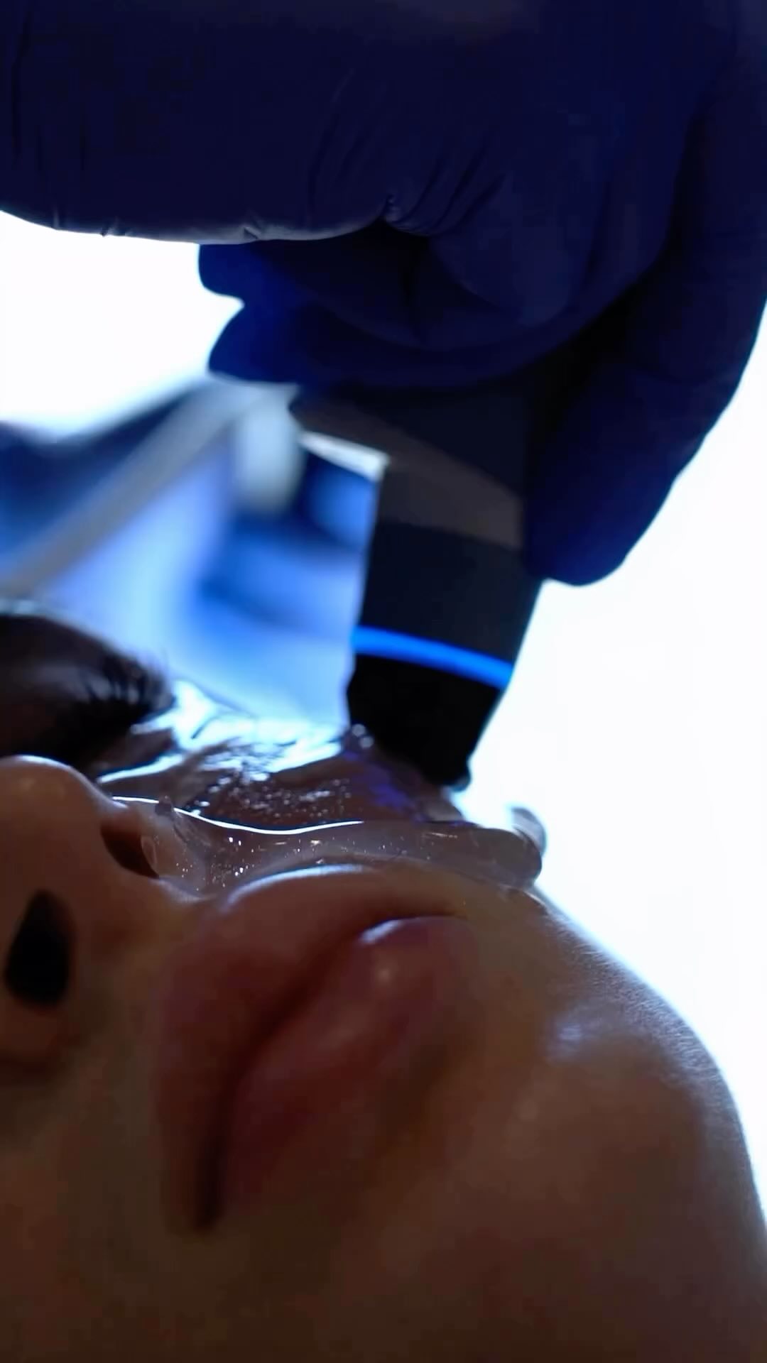 Exion Ultrasound Face Treatment❤️
