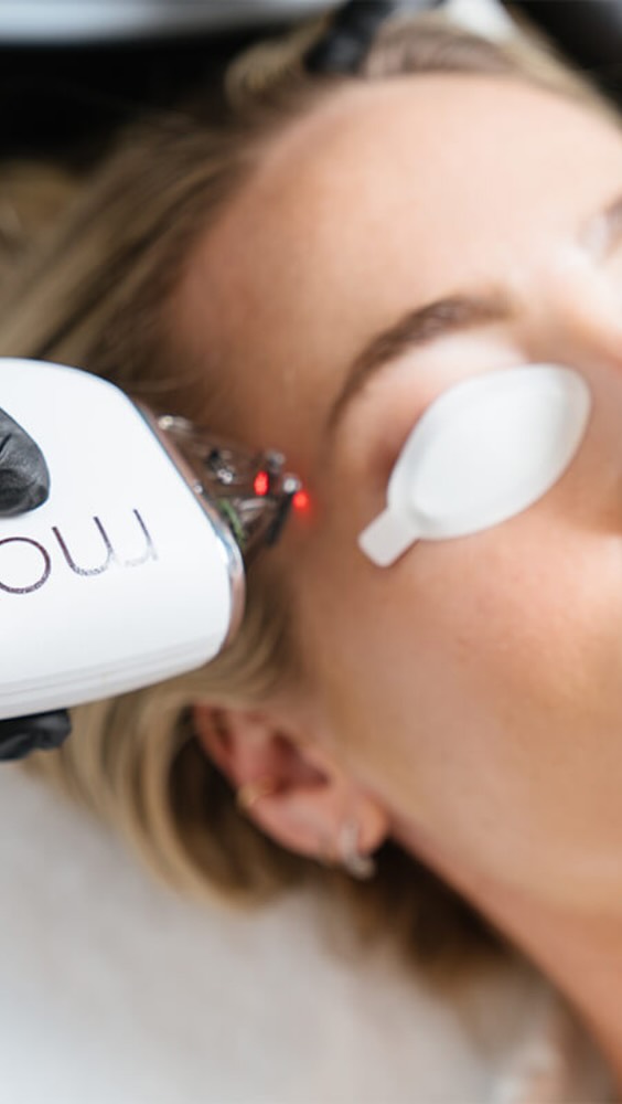 Moxi Laser is a non-ablative fractional laser designed for skin rejuvenation with minimal downtime. 