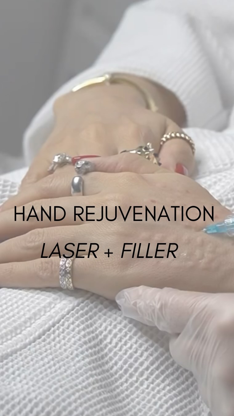 HAND REJUVENATION – THE ULTIMATE COMBO ✨