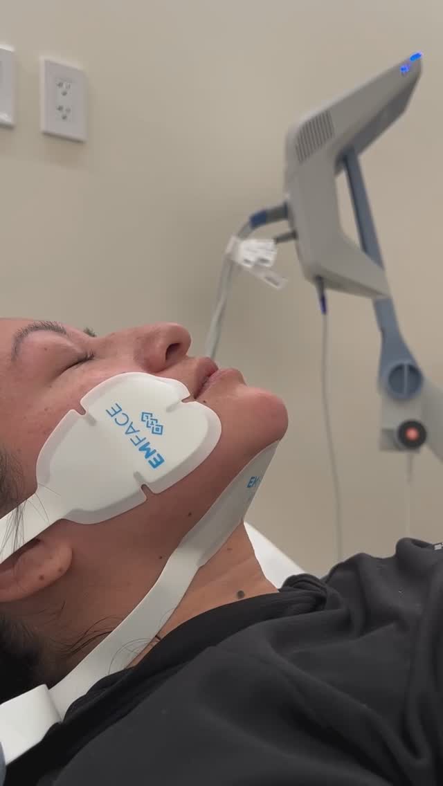 ✨ Lift, Tone & Tighten – No Needles, No Downtime! ✨