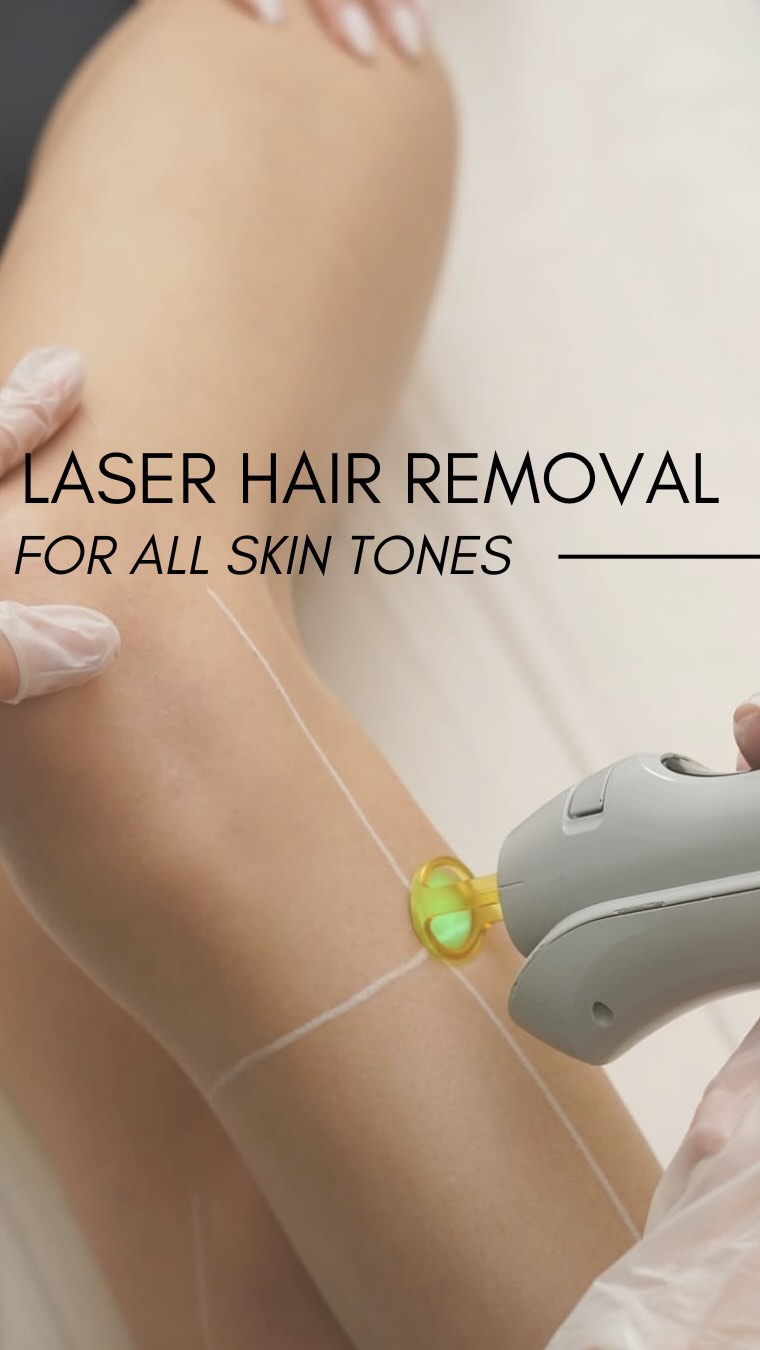 Laser Hair Removal with Candela GentleMax Pro🧡