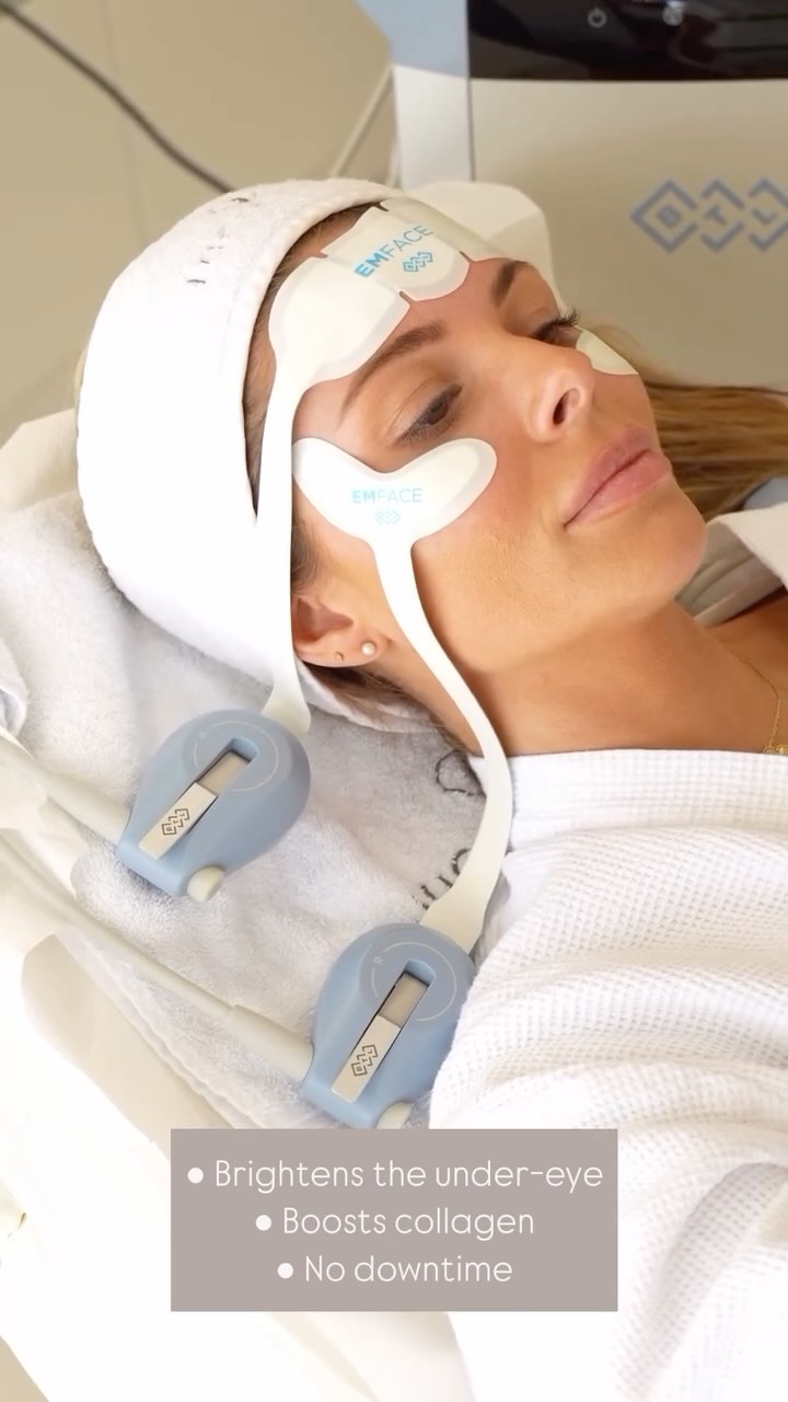 Now Available at Uderma Medspa: ✨ EMFACE Under-Eye Treatment ✨