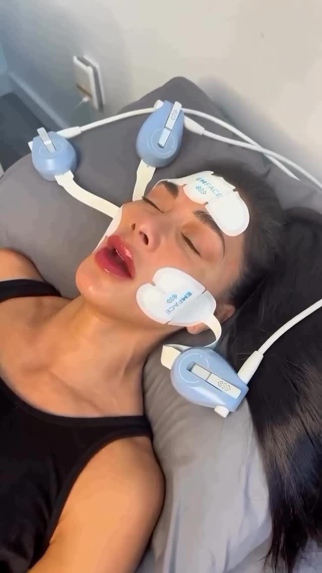 @nicolescherzinger opting for EMFACE for a lifted, youthful appearance 💖