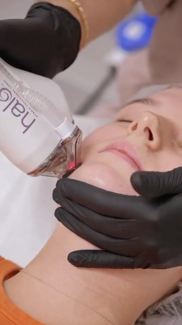 ✨ The ONLY Hybrid Fractional Laser on the market – HALO® ✨