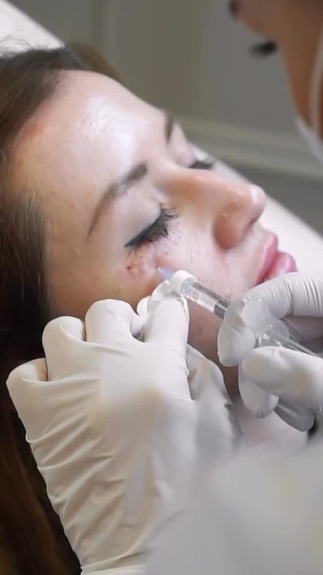 Restore, Revive & Rejuvenate the Eyes with Polynucleotides ✨