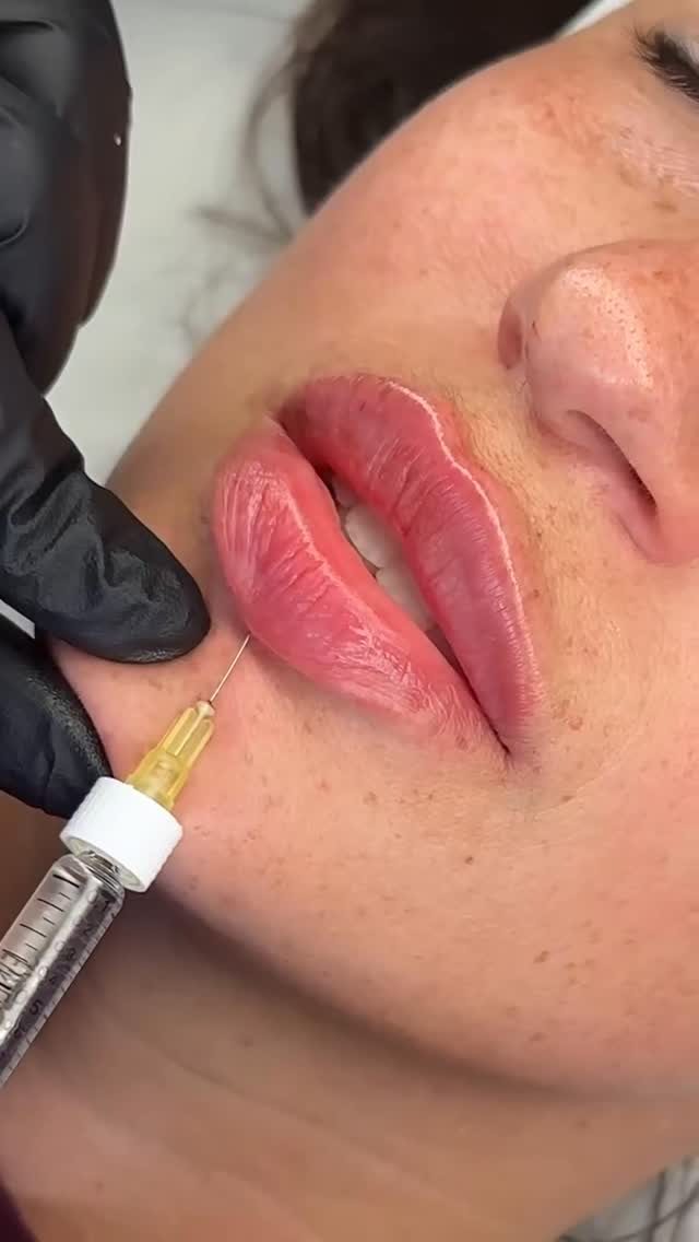Our signature tip technique is designed to enhance your lips with natural volume, perfect definition