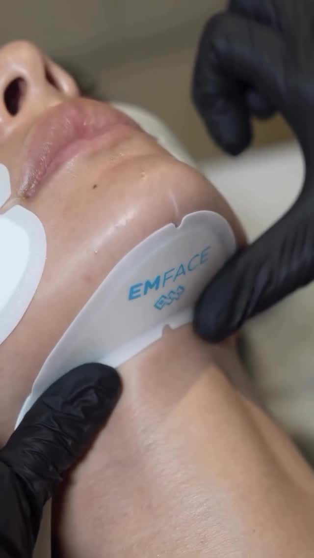 EMFACE® — a unique, non-invasive procedure for facial lifting, skin tightening, and muscle toning.